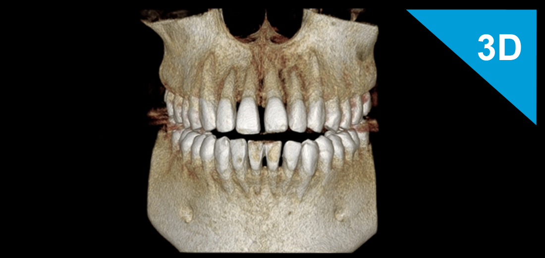 3D CBCT