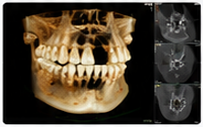 CBCT diagnisztika