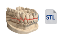 Fogászati CBCT Model Scan STL