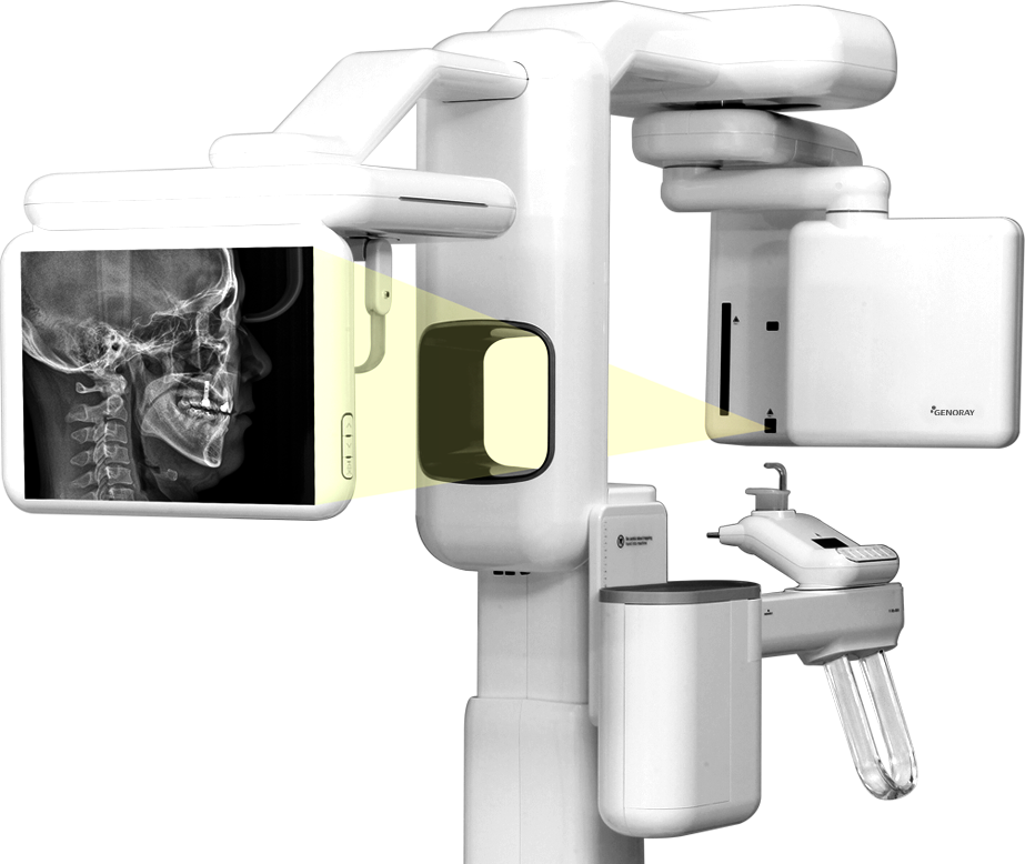 Genoray Papaya premium fogászati CBCT One Shot